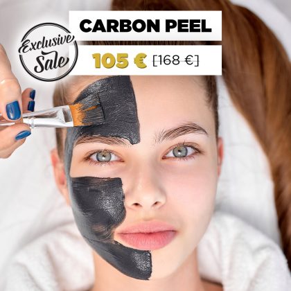 Carbon Peel